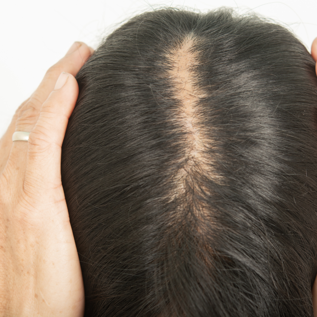 scalp micropigmentation for long hair